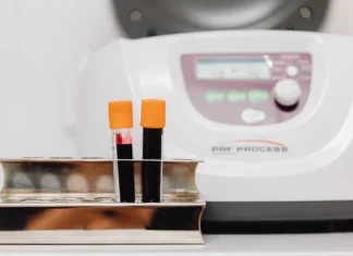 Яка різниця між сечовою кислотою і сечовиною? – експертна відповідь лікарів медичної лабораторії ДІЛА