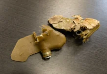 Чоловік в Архангельському втратив кисті через вибух невідомого предмета