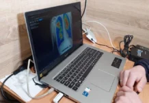 У двох громадах Херсонщини працюватиме мобільний рентгенологічний кабінет