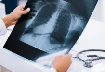 У трьох громадах Херсонщини працюватиме мобільний рентгенологічний кабінет