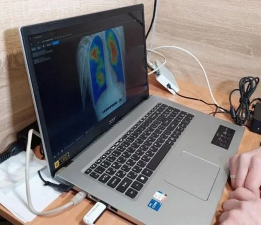 У двох громадах Херсонщини працюватиме рентгенологічний кабінет