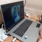 У трьох громадах Херсонщини проведуть безплатні рентгенологічні обстеження
